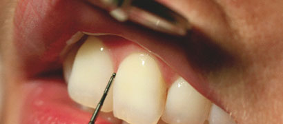 parodontolgie